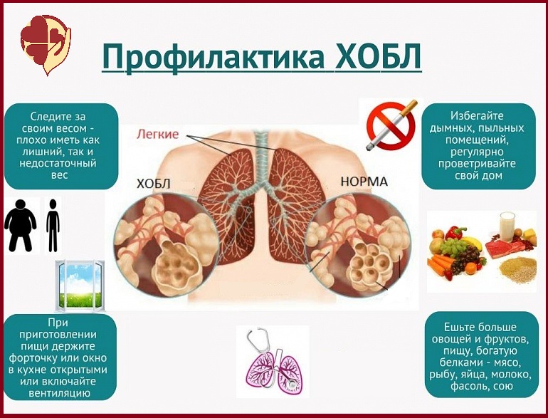 bezyimyannyiy4_0.jpg
